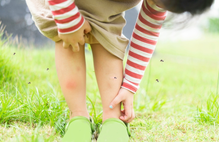 Una pianta per... le punture d'insetti: 5 rimedi naturali efficaci